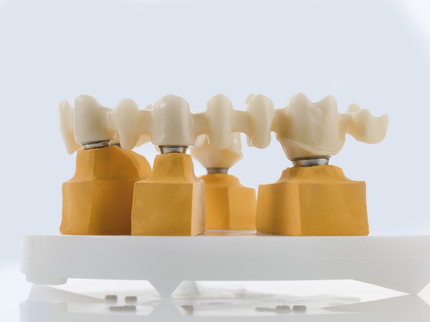 Implant